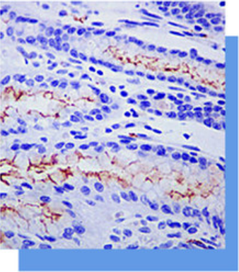 Helicobacter phlori抗體試劑